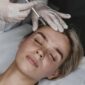 young woman getting beauty injection 85x85